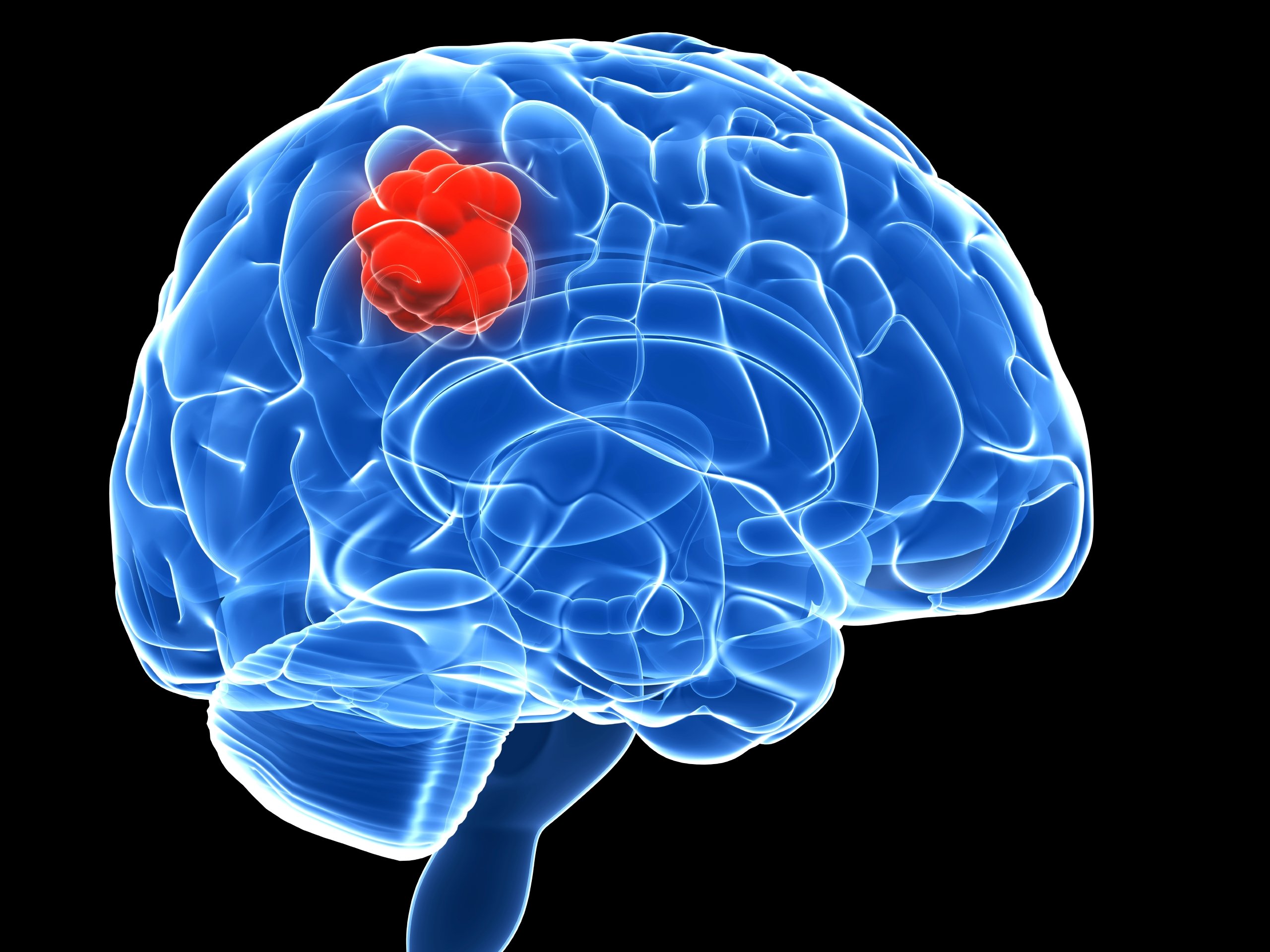 When a Medical Center Fails To Identify Child`s Brain Defects